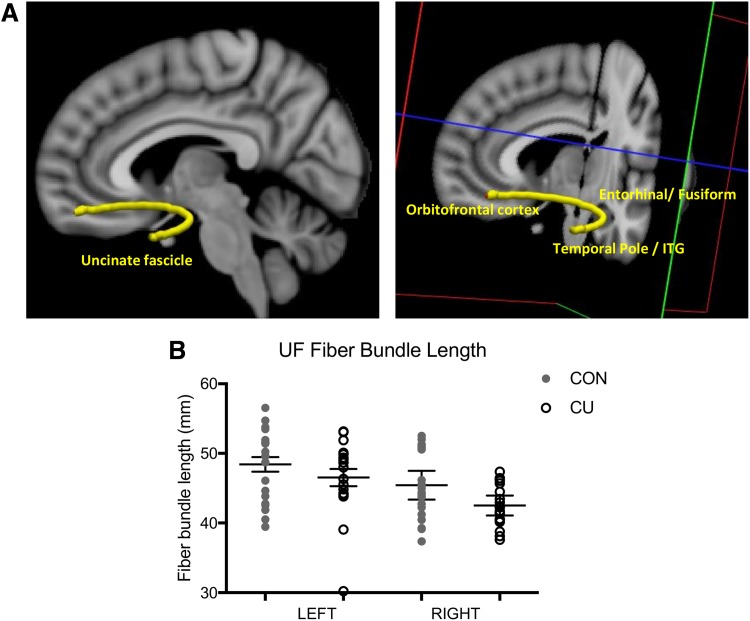 (A) Visualization of the bilateral uncinate fasciculus connecting the orbitofrontal poles, temporal poles, entorhinal cortex, fusiform gyri, and inferior temporal gyri, among all participants, using TRACULA. (B) Scatterplot of fiber bundle length for the left and right hemisphere for CU and CON. There was a significant reduction in fiber bundle length in the UF in CU compared to controls. CU, cannabis users; UF, uncinate fasciculus.