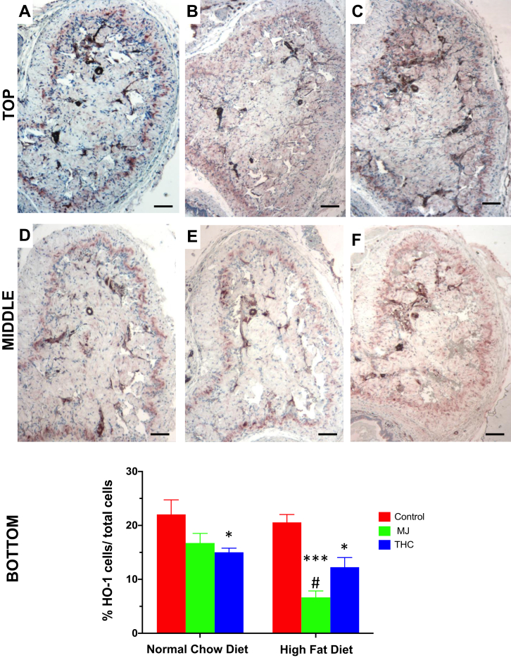The effect of HFD and oral MJ extract on heme oxygenase 1 expression. Heme oxygenase 1 (HO-1), a marker of antioxidative expression, within the cavernosa was determined by immunohistochemistry. Top panel: A: Control NCD; B: NCD + MJ; C: NCD + THC; Middle panel: D: Control HFD; E: HFD + MJ; F: HFD + THC. Bottom panel: QIA evaluation as %HO-1 cells/total cells means ± SEM. HO-1 expression was significantly reduced in the corpora of HFD + MJ group compared to the control NCD or HFD group (∗∗∗P < .001, ∗∗P < .01 respectively). A reduction in HO-1 expression was also seen in NCD + THC vs control NCD and HFD + THC vs control HFD (∗P < .05). Magnification = 100×; 1 bar = 100 μm.