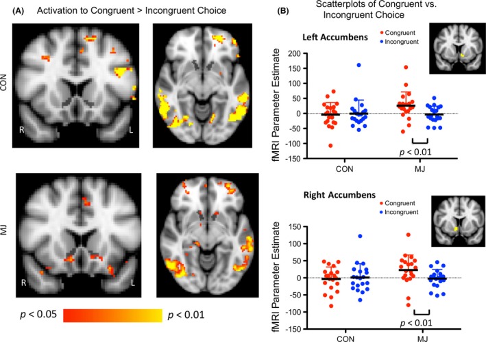 Activation during the choice phase when making congruent versus incongruent choices. (A) Voxelwise comparison of Activation During Congruent versus Incongruent Choices Within Each Group. Anatomical segmentation of the NAc is shown in black. Images are thresholded at P < 0.05, uncorrected. (B) ANOVAs between Group and Choice Activation. Segmentation‐based ROIs are shown in yellow. In the left NAc, there was an interaction between group and choice. Subsequent t‐tests revealed that there was more activation to congruent than to incongruent choices in MJ, but no significant difference in CON. In the right NAc, there was also an interaction between group and choice. T‐tests revealed that there was more activation to congruent than to incongruent choices in MJ, but no significant difference in CON.