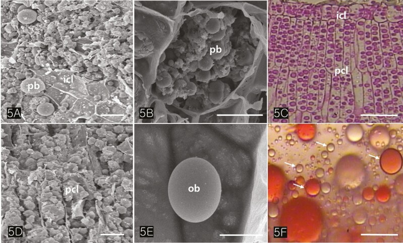 SEM and LM images of cotyledonary cells. (A) The large protein bodies and the small oil bodies can be distinguished. (B) An isodiametric cell of cotyledon illustrates a package of oil bodies and protein bodies. (C) LM image of cotyledon storage cells stained with toluidine bluebasic fuchsin. Each cotyledon consists of an isodiametric cell layer and a palisade cell layer. (D) The palisade cells containing both protein bodies and oil bodies are visible. (E) Close-up of an oil body in the cell. (F) The isolated oil bodies (arrows) stained with Sudan III are variable. Abbreviations: icl; isodiametric cell layer, ob; oil body, pcl; palisade cell layer, pb; protein body, sc; seed coat. Scale bars (A) = 50 µm; (B) = 10 µm; (C) = 50 µm; (D) = 10 µm; (E) = 5 µm; (F) = 2.5 µm.
