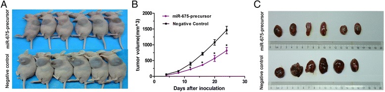 Overexpression of miR-675-5p inhibits NSCLC in vivo. (A) Tumor volumes of subcutaneous implantation models of NSCLC are shown. (B) Tumor growth curves of subcutaneous implantation models of NSCLC. (C) Tumor volumes in the orthotopic implantation models at week 4 are shown. Data were represented as the mean ± SEM of three independent experiments. Negative control: pGCsil-GFP Vector *P < 0.05.