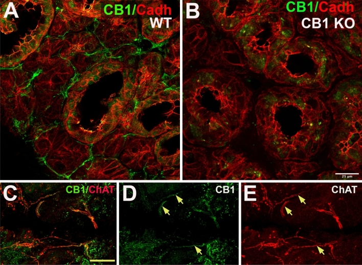 CB1 protein is expressed in a subset of cholinergic axons in submandibular gland. (A,B) Left panel shows CB1 (green) and cadherin (red) in wild type (WT) mouse submandibular gland. Right panel shows that CB1 staining in axon-like processes is absent submandibular gland from CB1 knockout mouse. (C) Double staining in submandibular gland of the mouse shows expression of CB1 (green) and choline acetyl transferase (ChAT, red), a marker for cholinergic axonal inputs. (D,E) CB1 (green) staining is seen in processes of ChAT-positive axons (arrows). Scale bar: (A,B) 25 µm; (C–E) 40 µm. Images processed using Adobe Photoshop vsn. 21.2 and FIJI (vsn 2.3.0/1.53q, available at https://imagej.net/Fiji/downloads).