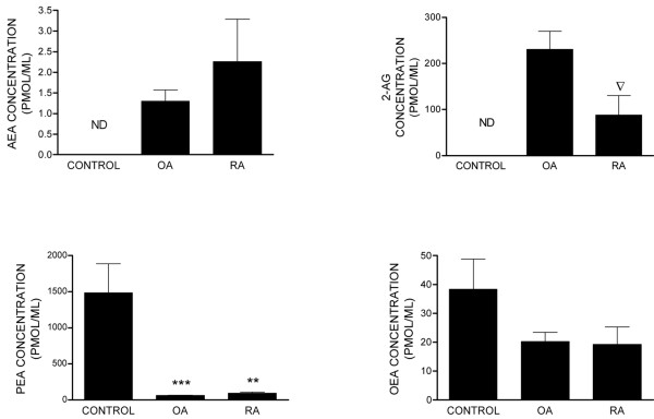 Levels of the endocannabinoids anandamide (AEA), 2-arachidonyl glycerol (2-AG), palmitoyl ethanolamide (PEA), and oleoyl ethanolamide (OEA) in synovial fluid of non-inflamed normal volunteers (control) (n = 6) and of patients with osteoarthritis (OA) (n = 14) and rheumatoid arthritis (RA) (n = 5). Data were analysed using the non-parametric Mann-Whitney test and are expressed as picomoles per millilitre. **P < 0.01, ***P < 0.005 compared with control values. ▽ P < 0.05 compared with OA values. ND, not detected below a limit of detection of 0.3 pmol/mL.