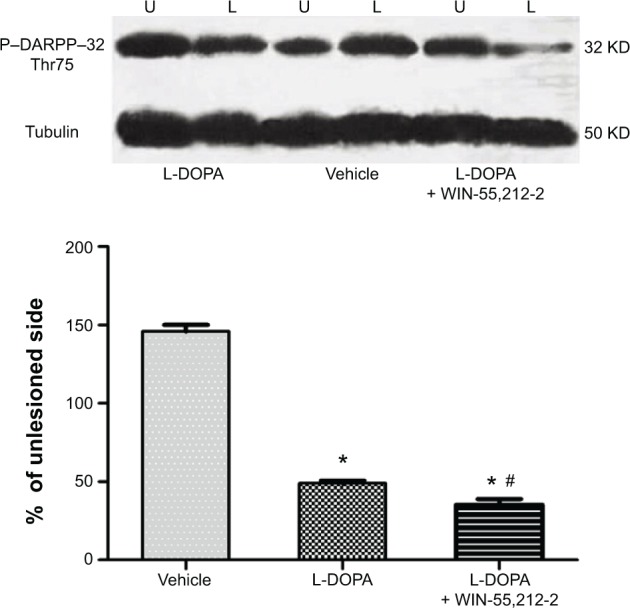Effects of chronic administration of WIN-55,212-2 on L-DOPA-stimulated DARPP-32 phosphorylation in 6-OHDA-lesioned rats.Notes: Representative Western blots are shown above the quantification of immunoblot results. Note that WIN-55,212-2 substantially changed L-DOPA-stimulated DARPP-32 phosphorylation. In the three groups of 6-OHDA-lesioned rats, daily injections of vehicle, vehicle plus L-DOPA, or WIN-55,212-2 plus L-DOPA were made for 21 days. At day 22, rats were sacrificed and striatal tissue was dissected for immunoblot analysis. Data are expressed as means ± SEM (n=6 per group). *P<0.05 versus vehicle; #P<0.05 versus vehicle plus L-DOPA.Abbreviations: 6-OHDA, 6-hydroxydopamine; DARPP-32, dopamine- and cAMP-regulated phosphoprotein of 32 kDa; IP, intraperitoneal; L, lesioned striatum; L-DOPA, L-3,4-dihydroxyphenylalanine; P-DARPP-32, phosphorylated DARPP-32; SEM, standard error of mean; U, unlesioned striatum.