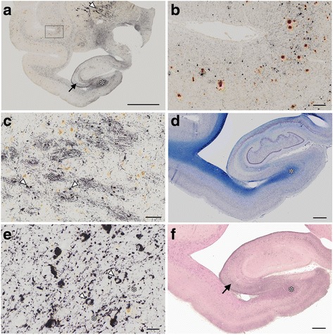 Amyloid beta and tau deposition in the 36-year-old monkey. Double staining for PHF tau (AT8, dark purple or black) and Aβ (brown) in brain slices from the 36-year-old monkey a. Pyramidal neurons were positive for AT8 (arrow, a). Higher magnification of a temporal lobe region, indicated by the large rectangle in a, is shown in b, again showing AT8-positive neurons in dark purple, and Aβ-positive deposits in brown. AT8 immunoreactivity (IR) was abundant in the globus pallidus (arrowhead in a) and in the white matter of the hippocampus (asterisk in a and d). In higher magnification images of the globus pallidus c, AT8 IR was found along fiber bundles (asterisk) and small round cells (arrowheads. See Fig. 4 for more details). Brown deposits are macrophages containing hemosiderin. Higher magnification of the hippocampal white matter (asterisk d and e) revealed AT8-positive oligodendroglia-like cells (arrowheads in e) and fibers (asterisks in e). The hippocampal white matter (asterisk, f) and pyramidal neurons (arrow, f) were also immunopositive with RD4 (dark purple staining in f) but not for RD3 (data not shown). Images (a–f) were captured using a virtual slide system VS120 (Olympus, Tokyo, Japan), equipped with “extended focus imaging”. Multiple images at different focal planes (17 planes with an interval of 0.5 μm) were fused into a single image. a–c, e: double staining for AT8 (dark purple) and Aβ (brown); d: Klüver-Barrera stain; f: RD4 immunostaining counter stained with nuclear fast red. Bars a:5 mm; b:200 μm, c:100 μm; d, f:1 mm, e:20 μm