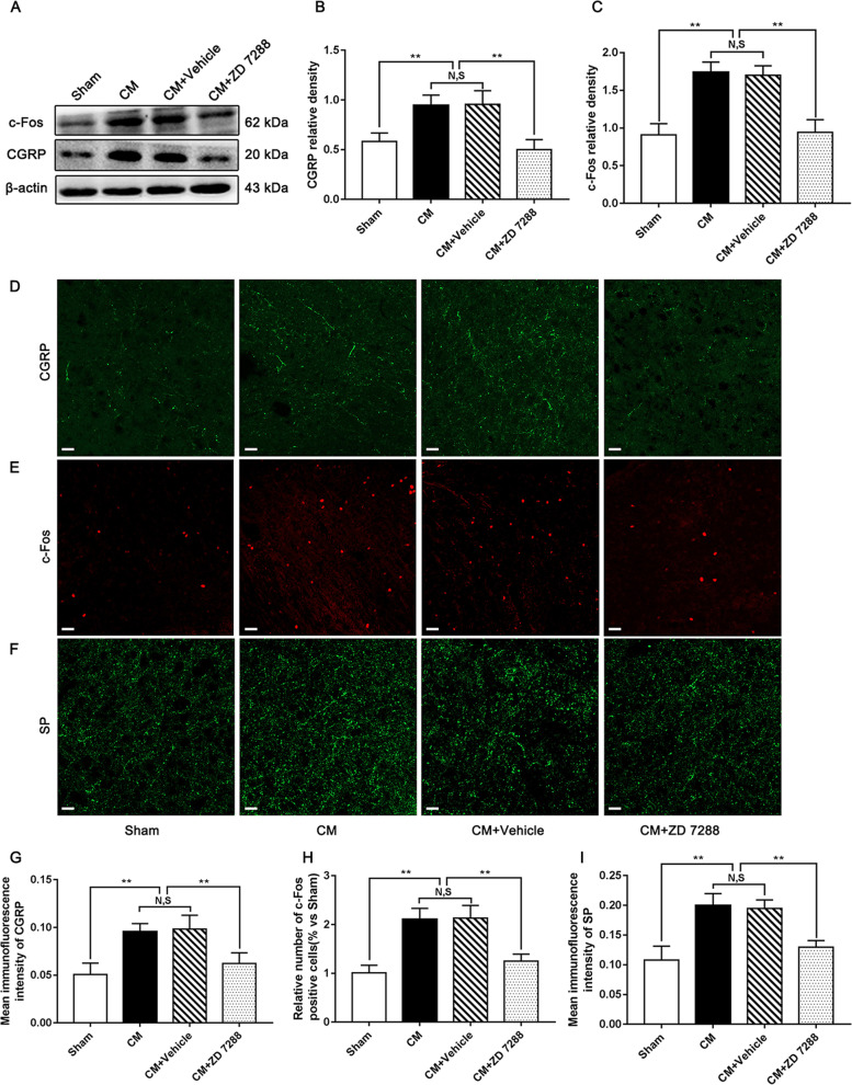 Regulation of central sensitization by ZD 7288 in CM rats. A Representative western blots of CGRP and c-Fos. B and C The protein levels of CGRP and c-Fos were significantly elevated in the CM group compared with those in the Sham group, and there was no statistical difference between the CM and CM + Vehicle groups. The expression levels of CGRP and c-Fos in the CM + ZD 7288 group drastically reduced compared to those in the CM + Vehicle group. (n = 6/group, **p < 0.01, N, S, not significant). D-F Immunofluorescence staining of c-Fos, CGRP, and SP in the PAG. G-I The number of c-Fos-positive cells and the average fluorescence intensity of CGRP and SP in the CM group were substantially increased compared to those in the Sham group, and there was no significant change between the CM and CM + Vehicle groups. The number of c-Fos-positive cells and the average fluorescence intensity of CGRP and SP in the CM + ZD 7288 group were visibly lower than those in the CM + Vehicle group. (n = 6/group, **p < 0.01, N,S, not significant, scale bar = 20 μm)