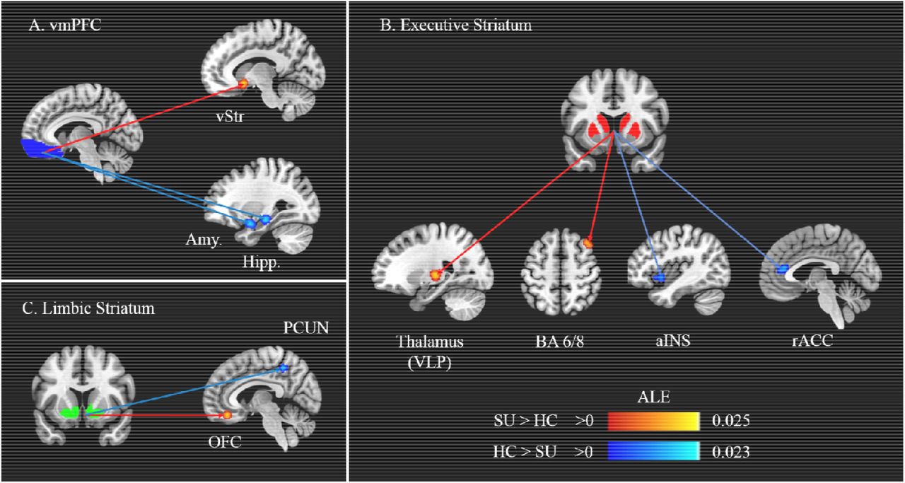 Summary of results from the ALE meta-analyses.A. Meta-analysis on disrupted connectivity associated with the ventromedial Prefrontal Cortex (Seed-of-Interest), B. Meta-analysis on disrupted connectivity associated with the Executive Striatum (Seed-of-Interest) and C. Meta-analysis on disrupted connectivity associated with the Limbic Striatum (Seed-of-Interest). Coloured lines represent hyperconnectivity (Red) and hypoconnectivity (Blue) in individuals with substance use / problems. vmPFC = ventromedial prefrontal cortex; vStr = ventral Striatum; Amy. = Amygdala; Hipp. = Hippocampus; PCUN = Precuneus; OFC = Orbitofrontal Cortex; VLP = Ventrolateral posterior; BA = Brodmann Area; aINS = anterior Insula; rACC = rostral Anterior Cingulate Cortex.
