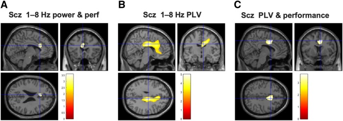 Exploratory whole-brain analyses revealed theta power and phase coupling effects in a mid-cingulate region in schizophrenia subjects. (A) In a whole-brain analysis, schizophrenia subjects’ (Scz) performance correlated with 1–8 Hz theta power in cingulate cortex only [peak (−6 22 24), Z = 2.90, Punc = 0.002]. The image is thresholded at Punc = 0.005 for display purposes. (B) A whole-brain PLV analysis of the schizophrenia group found the most significant increase in a mid-cingulate area [peak (8 −12 30), Z = 3.87, Punc < 0.001], close to the cingulate area showing a theta power correlation to performance in subjects with schizophrenia. (C) In schizophrenia subjects, PLV increase and performance also correlated in mid-cingulate cortex [peak (6 2 38), Z = 2.82, Punc = 0.002]; the PLV-performance relationship here was stronger in schizophrenia subjects than in controls [peak (2 4 36), Z = 2.81, Punc = 0.002]. Subjects with schizophrenia may thus be using this node of the frontoparietal control network to compensate for their hippocampal-mPFC circuit dysfunction in this task.