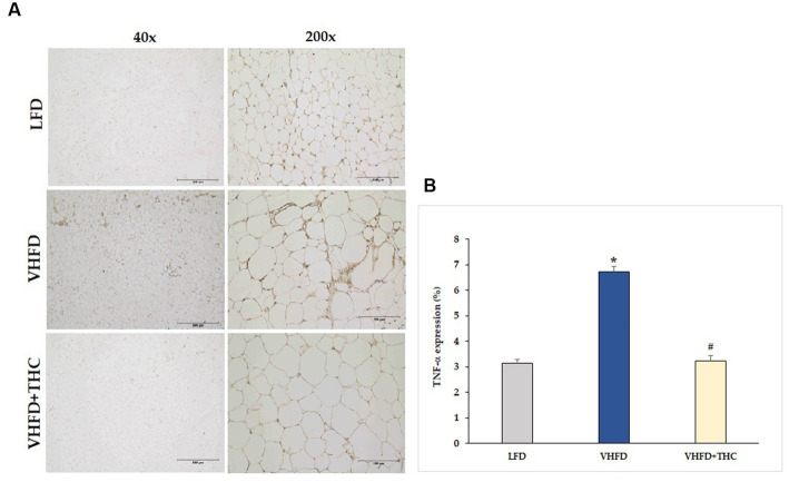 Effects of THC on TNF-α expression: (A) representative TNF-α expression; Left column, magnification 40x; scale bar = 500 μm; Right column, magnification 200x; scale bar = 100 μm; (B) % TNF-α expression. Data are presented as mean ± SEM. *p < 0.001 vs. LFD group; #p < 0.001 vs. VHFD group.