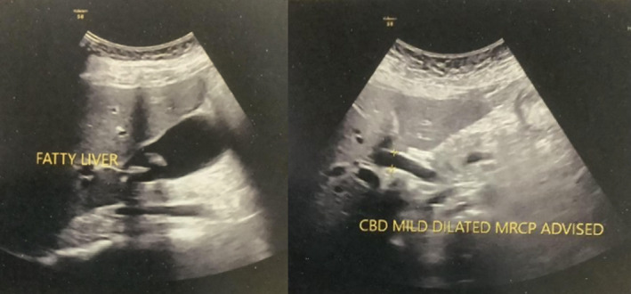 Ultrasonography scans of the patient.