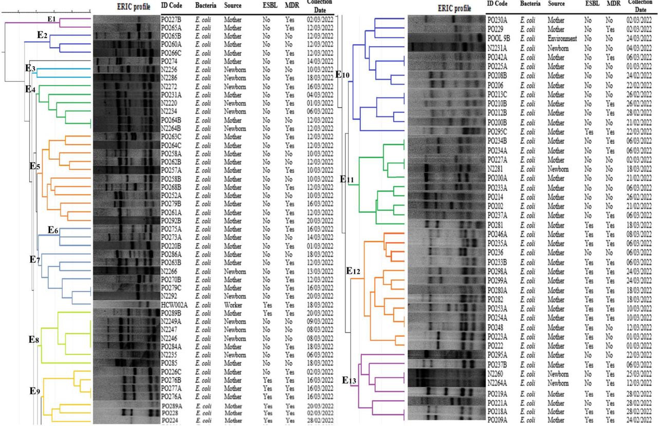 Genotypic relationship of E. coli strains (n = 93) detected from mothers, neonates, healthcare workers and the environment. Dendogram generated by GelJ using UPGMA method and the Dice similarity coefficient.
