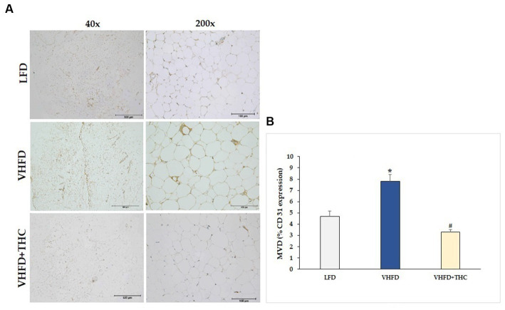 Effect of THC on adipose angiogenesis: (A) representative CD-31 expression; Left column, magnification 40x; scale bar = 500 μm; Right column, magnification 200x; scale bar = 100 μm; (B) MVD (% CD31 expression). Data are presented as mean ± SEM. *p < 0.001 vs. LFD group; #p < 0.001 vs. VHFD group.