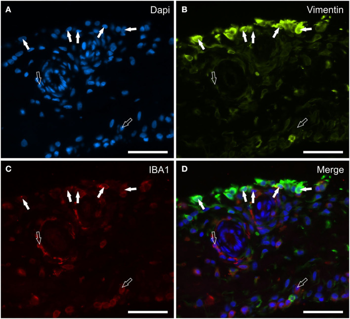 Photomicrographs of the cryosections of the synovial membrane of a horse metacarpophalangeal joint showing vimentin (B) and IBA1 (C) immunoreactivity. The white arrows indicate the DAPI (Blue) labeled nuclei (A) of some macrophage-like synoviocytes lining the synovial intima which co-expressed moderate IBA1 (Red) and bright vimentin (Green) immunoreactivity. The open arrows indicate subintimal macrophages, which were IBA1 immunoreactive and vimentin negative. (D) Merged image (Orange). Scale bar = 50 μm.
