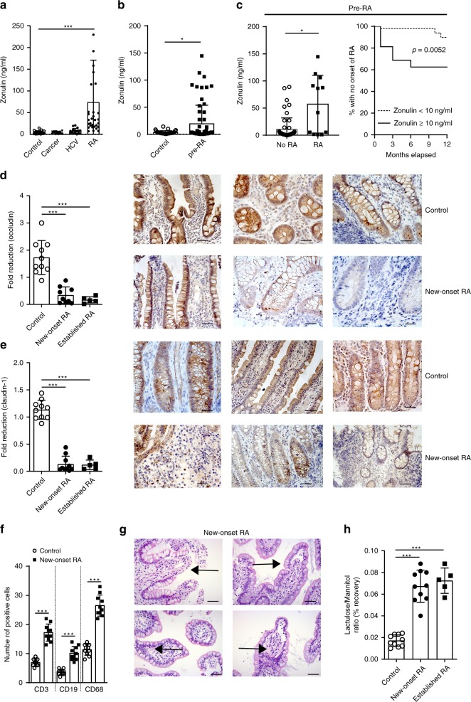 Zonulin family peptide levels and intestinal barrier dysfunction in human rheumatoid arthritis.a Serum zonulin family peptide (zonulin) levels in healthy controls (controls) (n = 41), cancer (n = 19), hepatitis C virus (HCV) (n = 21), and rheumatoid arthritis (RA) (n = 40) patients. b Serum zonulin levels in healthy controls (n = 41) and pre-RA patients (n = 32). c Serum zonulin levels in pre-RA patients with (n = 12) or without (n = 53) later development of RA (left panel); Kaplan–Meier graph showing loss of healthy state and progression to RA patients with low (<10) or elevated (≥10) zonulin levels over month relapsed (right panel). d Fold reduction of occludin expression determined in histological gut biopsy sections in healthy controls (n = 10), new-onset (n = 9) and established RA patients (n = 5) with representative microphotographs (occludin in brown) from three healthy control and three new-onset RA patients. Size bar: 20 µm. e Fold reduction of claudin-1 expression determined in histological gut biopsy sections in healthy controls (n = 10), new-onset (n = 10) and established RA patients (n = 5) with representative microphotographs (claudin-1 in brown) from three healthy control and three new-onset RA patients. Size bar: 20 µm. f Immunohistological quantification of gut infiltrating T cells (CD3), B cells (CD19) and macrophages (CD68) in gut biopsies from healthy controls or new-onset RA patients from stained gut biopsies (n = 10). g Representative H&E-stained gut biopsy microphotographs from a new-onset RA patient; arrows: signs of inflammation. Size bar: 20 µm. h Intestinal permeability assessed by lactulose/mannitol recovery ratio in urine of healthy controls (n = 10), and new-onset (n = 10) and established (n = 5) RA patients after 24 h. Data are expressed as the mean ± s.d. Statistical difference was determined by one-way ANOVA. *p < 0.05; ***p < 0.001. Source data are provided as a Source Data file.