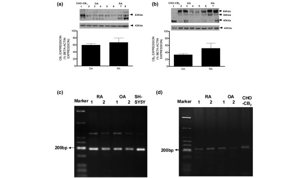 Expression of cannabinoid receptor 1 (CB1) (a) and cannabinoid receptor 2 (CB2) (b) receptor protein in synovial tissue of patients with osteoarthritis (OA) (lanes 2 to 5) or rheumatoid arthritis (RA) (lanes 6 to 8) detected by Western blotting and quantified by densitometry. CHO-K1 cells recombinantly expressing either CB1 or CB2 receptor were used as a positive control (lane 1). Receptor expression was calculated as a percentage of expression of the internal control, β-actin. Data are presented as mean ± standard error of the mean of the expression of CB1 and CB2 protein in four OA and four RA patients, assessed in three separate experiments. Expression of CB1 (c) and CB2 (d) receptor RNA in fibroblast-like synovial cells derived from tissue of patients with OA or RA detected by 'touchdown' polymerase chain reaction. A human neuroblastoma cell line (SH-SY5Y) endogenously expressing CB1 cannabinoid receptor and CHO-K1 cells recombinantly expressing CB2 receptor were used as positive controls, respectively. bp, base pairs.