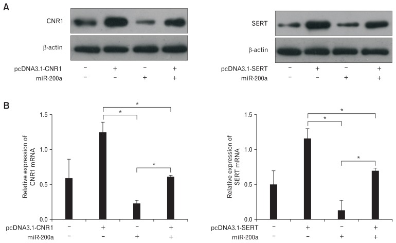 Overexpression of cannabinoid receptor 1 (CNR1) and serotonin transporter (SERT) partially rescued the inhibitory effects of microR-NA-200a (miR-200a) on diarrhea-predominant irritable bowel syndrome rat colonic epithelial cells (CECs). (A) Western blots showed that the expression of CNR1/SERT was significantly upregulated in CECs transfected with pcDNA3.1-CNR1/SERT but significantly downregulated in CECs transfected with miR-200a. In addition, a significant increase in CNR1/SERT was detected in CECs transfected with pcDNA3.1-CNR1/ SERT alone compared to CECs co-transfected with pcDNA3.1-CNR1/SERT and miR-200a. (B) Quantitative RT-PCR shows similar results to western blot (P < 0.05, ANOVA and least significant difference).