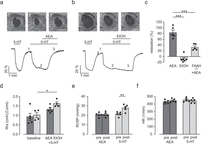 AEA induces airway relaxation ex vivo and in vivo in healthy mice.a, b Top: phase contrast microscopy pictures of a small intrapulmonary C57BL/6J mouse airway. 1–3) Pictures represent time points during perfusion in the graph (bottom), scale bar = 50 µm. Bottom: Original trace of changes in airway lumen area. AEA (10 µM) completely reverses the reduction of lumen area by serotonin (5-HT, 0.1 µM) (a) while the solvent EtOH has no effect (b). c Statistical analysis reveals strong airway relaxation by AEA in intrapulmonary airways of C57BL/6J mice (AEA n = 5, EtOH n = 6 independent samples) that is attenuated in FAAH−/− mice (n = 5, independent samples), one way ANOVA, Tukey´s post hoc test (AEA vs EtOH ***p = 3.2 × 10−7; AEA vs AEA + FAAH−/− ***p = 2.6 × 10−4). d Analysis of airway resistance at baseline and after the subsequent inhalation of 25 mg/ml 5-HT together with AEA (0.5 mg per mouse, n = 5 independent animals) or the solvent EtOH (n = 4 independent animals) in healthy C57BL/6J mice. AEA limits the increase of airway resistance by 5-HT. Repeated measures two way ANOVA, Bonferroni’s post hoc test *p = 0.014. e Analysis of right ventricular systolic pressure (RVSP) before (pre) and after (post) inhalation of AEA (0.5 mg per mouse) or 5-HT (50 mg/ml) as positive control in C57BL/6J mice (n = 5 independent animals); AEA inhalation has no effect on RVSP. Repeated measures two way ANOVA, Bonferroni’s post hoc test **p = 0.0026. f Analysis of heart rate (HR) of C57BL/6J mice (n = 5 independent animals) before (pre) and after (post) inhalation of AEA (0.5 mg per mouse) or 5-HT (50 mg/ml); AEA and 5-HT have no effect on HR. All data are presented as mean values ± SEM. Source data are provided as a Source Data file.