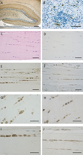 CB1 and CB2 receptor expression in positive controls and human fascia. The positivity for CB1 is evident in dentate gyrus of the rat hippocampus (A), whereas CB2-receptor-positive cells of immune system are shown in human spleen (B). Paraffin sections of the human fascia stained with H&E (C), immunostaining negative controls Hematoxylin stained (D), CB1 receptor expression in human fascia of two different subjects (E,G,I), CB2 receptor in other two subjects (F,H,J). Scale bars: 50 µm.