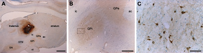 Retrograde CTB labeling of pallidothalamic-projecting neurons. CTB deposits were placed at the level of VA/VL thalamic nuclei in control, parkinsonian and dyskinetic monkeys. Following CTB injection in VA/VL nuclei (a), a large number of retrogradely labeled neurons were found throughout all territories of the GPi nucleus (b). Panel c shows an inset taken from panel B at a higher magnification. Scale bar is 3,000 μm in panel a, 1,000 μm in panel b, and 100 μm in panel c. ac anterior commissure, GPe external division of the globus pallidus, GPi internal division of the globus pallidus, ic internal capsule, SN substantia nigra, STN subthalamic nucleus, ot optic tract