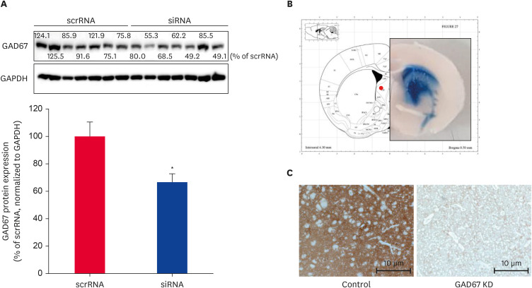 Confirmations of GAD67 protein expression and working of the CRISPR/Cas9 system in mice striatum. (A) Mice were stereotaxically treated with either a negative control (scrRNA) or GAD67 siRNA in the right striatum. The protein expression of GAD67 was confirmed by western blotting. Expression of each protein was normalized to the relative amplification of GAPDH. Data are expressed as the mean ± standard error (n = 7 for each group) and were analyzed using a Student’s t-test (*p < 0.05 vs. scrRNA group). (B) Mice were stereotaxically injected with the control or GAD67 gRNA CRISPR/Cas9 vector. (C) Immunohistochemical staining of GAD67 in the mice striatum sections (10 µm thick). Original magnification is ×200, scale bar = 10 µm.GAD67, glutamic acid decarboxylase 67; GAPDH, glyceraldehyde-3-phosphate dehydrogenase; scrRNA, scramble RNA.