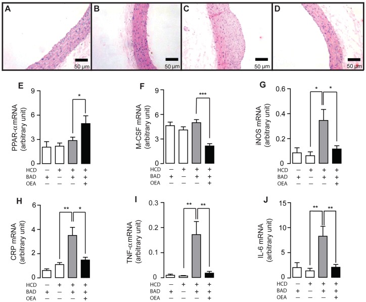 OEA prevented atherosclerotic plaque formation in BAD rats.(A–D), The effect of vehicle (A–C) or OEA (D) on atherosclerotic plaque formation in BAD rats fed with normal diet (BAD-ND, A), sham-operated rats fed with high-caloric diet (sham-HCD, B), and BAD rats fed with HCD (BAD-HACD, C-D). Scale bar, 50 μm. (E–J), The effect of vehicle (−) or OEA (+) on mRNA expression levels of PPAR-α (E), M-CSF (F), iNOS (G), CRP (H), TNF-α (I) and IL-6 (J) in aorta tissues of BAD-ND rats, sham-HCD rats and BAD-HCD rats. Vehicle, 5% PEG/5% Tween-80 in saline; OEA, 5 mg/kg/day, i.p.; * p<0.05, ** p<0.01, *** p<0.001, one-way ANOVA, n = 7–9 rats/group.