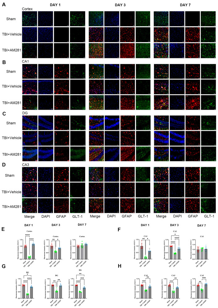 TBI-induced downregulation of GLT-1 expression in astrocytes was reversed by inhibiting the CB1 receptor. (A–D): Representative immunofluorescent images demonstrating the expression of GFAP (Red), DAPI (Blue), and GLT-1 (Green) in the cortex (A), CA1 (B), DG (C), and CA3 (D) of Sham, TBI + AM281, and TBI + Vehicle group on days 1, 3, 7 post-TBI. (E–H): Quantification of immunofluorescence images in (A–D). n = 9 slices from 3 mice per group. Bar = 10 μm. All data were presented with the mean ± SEM. * p < 0.05, ** p < 0.01, *** p < 0.001, **** p < 0.0001.