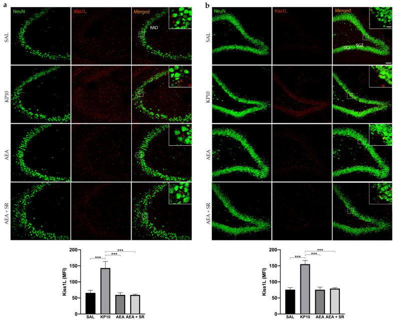 Expression and distribution of Kiss1L in the hippocampus. Representative images showing double IF staining for NeuN (green) and Kiss1L (red) expression in rat CA3 (a) and DG (b) of control (SAL), kisspeptin (KP10), anandamide (AEA), and SR141716 plus AEA-treated animals (n = 5 for SAL, AEA, and AEA + SR; n = 4 for KP10). Scale bar = 75 μm. High magnification insets show partial colocalization between Kiss1L and NeuN in the dentate gyrus. Scale bar = 15 μm. Histograms show the mean fluorescence intensity (MFI) of Kiss1L expression in hippocampal CA3 (a) and DG (b) of treated and untreated groups. RAD, stratum radiatum; SGZ, subgranular zone; GCL, granule cell layer. Data are expressed as mean ± SEM. ***, p < 0.001 vs. controls.