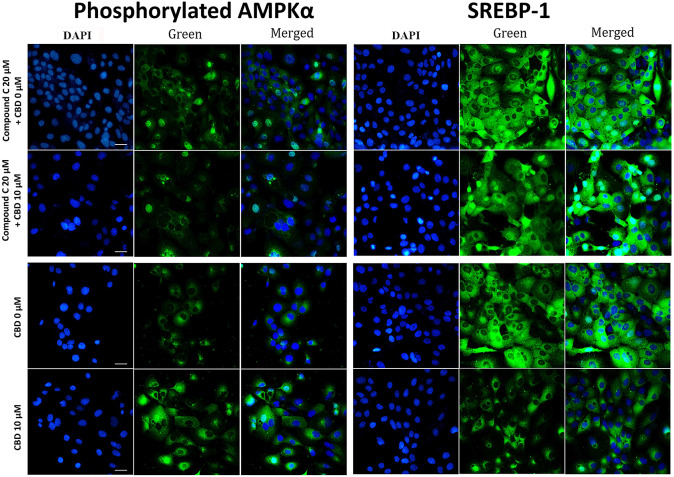 Representative DAPI staining images of CBD treated SEB-1 cells. Representative DAPI staining images of CBD treated SEB-1 cells. SEB-1 cells were treated with CBD at concentrations of 0 µM and 10 µM for a duration of 48 h. DAPI staining was performed to assess the impact of CBD treatment. Phosphorylated AMPKα expression and SREBP-1 expression were evaluated using DAPI staining (400X). All are at the same magnification (bar = 50 μm). CBD, cannabidiol; SREBP, sterol regulatory element binding protein; AMPK, AMP activated protein kinase; DAPI, 4’,6-diamidino-2-phenylindole