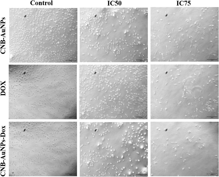 Cytomorphological images of A549 cells treated with IC50 and IC75 of CNB-AuNPs-Dox, Dox, and CNB-AuNPs for 24 h were analyzed by phase contrast microscopy. The images shown are representative of three independent experiments performed in triplicate (Magnification ×20; Scale bar 100 µm).
