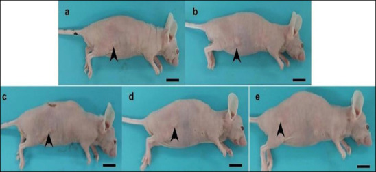 Gross appearance of tumors in mice subcutaneously injected with 1 × 107 MCF-7 cells. (a) Negative control, gavaged with sesame oil; (b) positive control, treated with 5-fluorouracil (5-FU, 20 mg/kg, intraperitoneally, three times per week); (c) THC:CBD (1:6) low-dose group, gavaged at 2 mg/kg BW; (d) THC:CBD (1:6) intermediate-dose group, gavaged at 10 mg/kg BW; (e) THC:CBD (1:6) high-dose group, gavaged at 20 mg/kg BW. Scale bar = 1 cm. Tumor masses were located subcutaneously and appeared as small nodules at the sites indicated by the arrows. 5-FU = 5-fluorouracil, BW = Body weight, THC: CBD = tetrahydrocannabinol:cannabidiol, SD = Standard deviation.