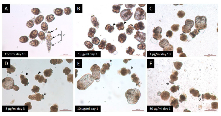 Light microscopy of E. granulosus s.s. protoscoleces treated in vitro with different CBD concentrations. (A) Observe the typical protoscoleces morphology: (r) rostellum, (su) suckers, (so) soma and (sc) scolex. Note the presence of morphological alterations: (B,D) soma contraction (black arrow head); (C) tegumental damage; (E) presence of blebs (*); and (E,F) rostellar disorganization (white arrow head).