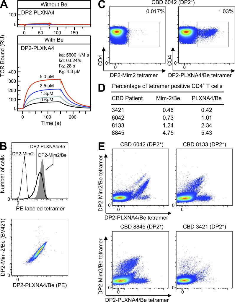 HLA-DP2–PLXNA4/Be tetramer staining of ex vivo BAL cells from CBD patients. (A) The binding kinetics of soluble AV22 TCR to biotinylated HLA-DP2–PLXNA4 with and without Be are shown. Four concentrations of soluble AV22 TCR were injected through the flow cells before and after loading with 200 µM BeSO4, and the surface plasmon resonance signal was obtained. Data shown are representative of three independent experiments. (B) Staining of the AV22 T cell hybridoma with HLA-DP2–mimotope-2, HLA-DP2–mimotope-2/Be, and HLA-DP2–PLXNA4/Be tetramers individually (top) and costaining with Be-saturated mimotope-2 (BV421 labeled) and PLXNA4 (PE labeled) tetramers (bottom). The fluorescence intensity of cells was evaluated after staining with 20 µg/ml of tetramers for 2 h at 37°C. Representative results from three independent experiments are shown. (C) Density plots showing control HLA-DP2–mimotope-2 without Be (left) and HLA-DP2–PLXNA4/Be (right) tetramer staining of CD4+ T cells from ex vivo BAL cells of a HLA-DP2+ CBD patient. Results are representative of four HLA-DP2+ CBD subjects stained. (D) Summary of the frequency of tetramer staining of ex vivo BAL CD4+ T cells from four HLA-DP2+ CBD patients individually stained with the HLA-DP2–mimotope-2/Be and HLA-DP2–PLXNA4/Be tetramers. (E) Density plots of ex vivo BAL cells from four DP2+ CBD patients costained with HLA-DP2–PLXNA4/Be and HLA-DP2–mimotope-2/Be tetramers are shown.