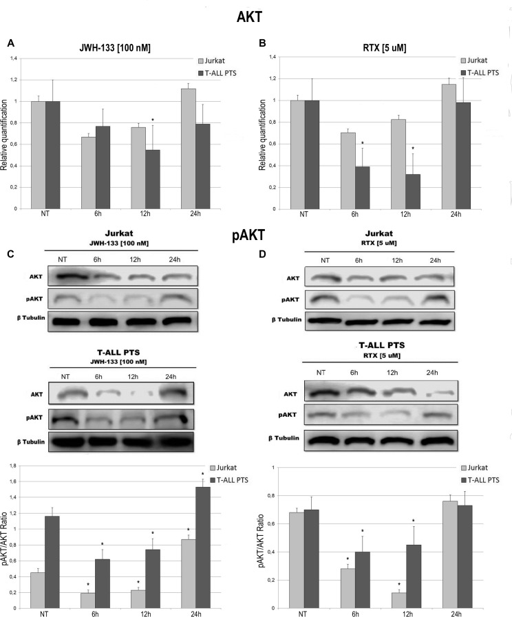 Effects of JWH-133 and RTX treatments on AKT mRNA expression levels and pAKT protein expression levelsAKT mRNA expression levels in Jurkat cell line and in T-ALL patients’ lymphoblasts derived from 4 patients were determined by Q-PCR after JWH-133 [100 nM] (A) and RTX [5 uM] (B) treatments after 6 h, 12 h and 24 h of exposure. Results were normalized for the housekeeping gene β-actin and were showed as mean ± SD of three independent experiments for Jurkat cells (performed in technical triplicate), and as mean ± SD of four single experiments on each one of the 4 patients (performed in technical triplicate). A t-test has been used to evaluate statistical differences in AKT expression among groups. *indicates p ≤ 0.05 compared to the untreated control (NT). AKT and pAKT protein expression levels in Jurkat cell line and in T-ALL patients’ lymphoblasts, were determined by Western Blot, starting from 15 μg of total lysates after JWH-133 [100 nM] (C) and RTX [5 uM] (D) treatments after 6 h, 12 h and 24 h of exposure. The images show the most representative blots. The proteins were detected using Image Studio Digit software and the intensity ratios of immunoblots compared to the one of the untreated control, taken as 1(arbitrary unit), were quantified after normalizing with respective loading controls for the housekeeping protein β-tubulin. The graphs show the ratio between pAKT and AKT as the mean ± SD of two independent experiments for Jurkat cells and as mean ± SD of four single experiments on each one of the 4 patients. A t-test has been used to evaluate the statistical differences in protein expression levels. * indicates p ≤ 0.05 compared to the untreated control (NT).