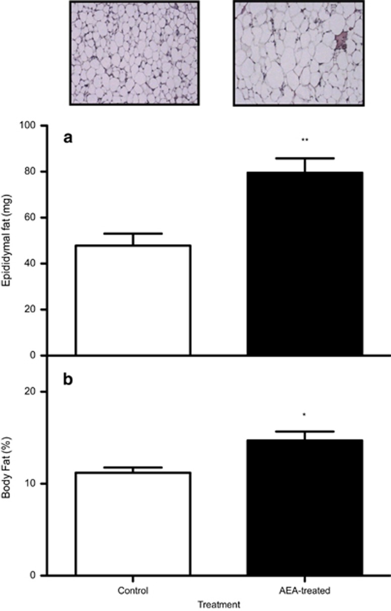 (a) Effect of AEA treatment during lactation on the total amount of epididymal fat and adipocyte size in 21-day-old control and AEA-treated animals. **P<0.01 (Mann–Whitney U-test; mean±s.e.m.; n=6 animals/group). (b) Effect of AEA treatment during lactation on total body fat content in 21-day-old mice. *P<0.05 (Mann–Whitney U-test; mean±s.e.m.; n=6 animals/group).