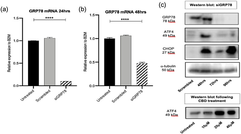 GRP78 knockdown in Panc03.27 cells does not affect the ATF/CHOP arm of the UPR pathway. (a) and (b) qPCR for GRP78 mRNA following transfection with 5 nM siGRP78 for 24 and 48 h. (c) Western blot (s) of housekeeping gene, alpha-tubulin, GRP78, ATF4 and CHOP following siRNA treatment and below plot represents ATF4 following 48 h treatment with cannabidiol at 10, 20 and 40 µM in Panc03.27 cells
