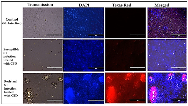 Panels showing the immunofluorescence images of S. typhimurium infection of Vero cells and counter treatment with CBD. ST-S. typhimurium.