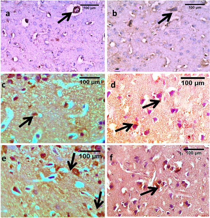 Photomicrographs of cortical brain sections for CB1 receptor immune expression in WIN55, 212–2 treated mice and controls. Images a, c & e represent female mice sections and b, d &f images represent male sections. Image a control and vehicle females and b: control and vehicle males. Controls showed more expression of CB1 receptors in female mice. Positive neurons are marked with arrows. Images c & d showed the low dose groups with higher immune expression compared to the control and vehicle groups which are more marked in female mice. Images e & f: high dose groups showed more CB1 expression than the low dose groups (scale bar = 100um)