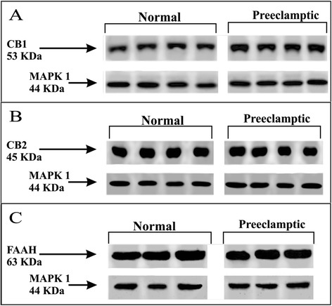 Representative Western blotting demonstrating CB1 (A), CB2 (B) and FAAH (C) expressions in normal and preeclamptic placental tissue.