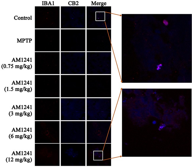 Immunostaining for neurogenesis in cortex and brainstem of MPTP-induced PD miceNearly no TH-positive cells were observed. The regeneration of GFAP -positive astrocytes was enhanced with the increase of the dose of AM1241.