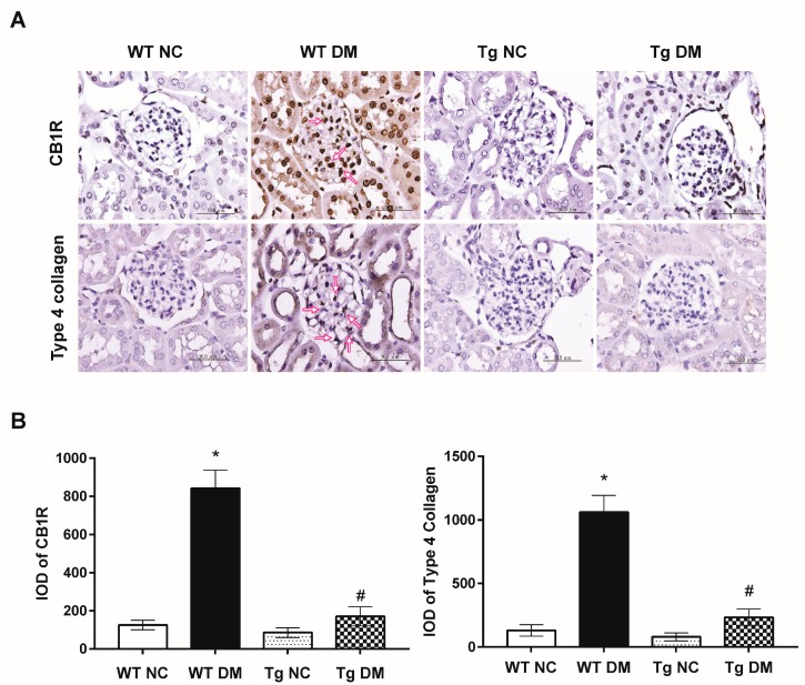 (A) Representative images of immunohistochemistry for CB1R and type 4 collagen in renal sections of study animals. Arrows indicate positive staining over mesangial cells or the mesangium. (B) The integrated optical density (IOD) of CB1R and type 4 collagen IHC-stained materials were analyzed . Data are presented as means ± standard errors calculated from six independent experiments. The symbol * indicates significant difference vs. the WT NC group (p < 0.05); the symbol # indicates significant difference vs. the WT DM group (p < 0.05).