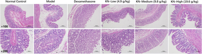 H&E staining results of rat adherent intestinal tissues (×100, × 200).