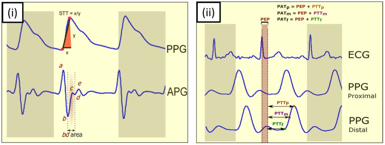 Sample ECG Signal