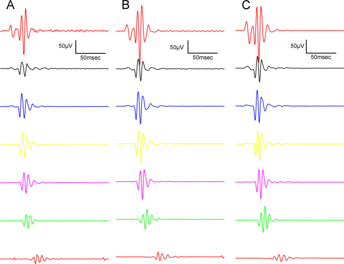 Dark-adapted oscillatory potential (OP) waveforms elicited by flash light series (from the bottom to the top: 10, 100, 300, 1000, 3000, 10000, 25000 mcd·s/m2). A Lean group; B ZDF group; C ZDF + CBD group