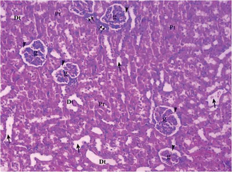 Renal tissue in control group (Group C). Pt: Proximal tubule, Dt: Distal tubule, g: glomerular, arrow head: bowman space, arrow: dilated tubule, double arrow: macula densa (H&EX10).