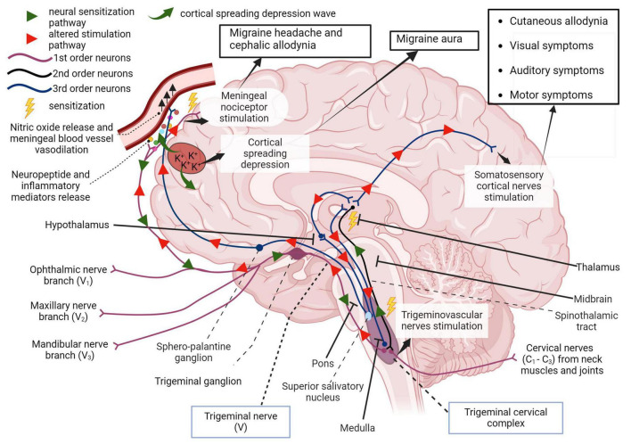 First order afferent nerves of the trigeminal nerve (cranial nerve V) transmit sensory information from the orofacial region and meninges for signal processing in the thalamus. In migraine, peripheral sensitization may occur when neuroinflammatory peptides such as CGRP, as well as processes that lead to mast cell degranulation, cause the downstream sensitization of nerves in the trigeminal pathway. In addition, cortical spreading depression which involves an increase in extracellular potassium ions and enhanced glutamatergic signaling can also trigger this neurogenic response and is also responsible for the symptoms associated with migraine aura. Localized meningeal nociceptor sensitization is another outcome of these processes. The altered afferent signaling pathway sensitizes second order nerves in the trigeminal cervical complex via the trigeminal ganglion and impulses reach the thalamus via the spinothalamic tract. Third order neural projections from the thalamus that innervate the somatosensory cortex, hypothalamus and other areas of the brain undergo an aberrant stimulatory process that causes somatic symptoms of migraine such as extracephalic (cutaneous) allodynia, auditory, visual, and motor impairment. Descending pathways from the thalamus also sensitize the hypothalamus to cause a parasympathetic outflow through the superior salivatory nucleus that promotes nitric oxide release and vasodilation in meningeal blood vessels. The trigeminal nerve endings also secrete neuropeptides that sensitize meningeal nociceptors to cause headache and/or cephalic allodynia (Goadsby et al., 2017; Ashina et al., 2019; Mungoven et al., 2021, 4). Adapted from BioRender (2024).
