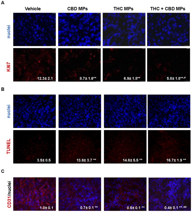 Cannabinoid loaded microparticles activate apoptosis and inhibit proliferation and angiogenesis of U87 MG cell-derived tumour xenografts.Effect of THC-loaded MP, CBD-loaded MP and a mixture of THC- and CBD-loaded MP on cell proliferation (as determined by KI67 immunostaining; A), apoptosis (as determined by TUNEL; B) and angiogeneis (as determined by CD31 immnunostaining; C) of U87MG cell-derived tumor xenografts. Values on the lower right corner of each panel correspond to the percentage of KI67-positive cells relative to the total number of nuclei in each section ± s.d. (A), the percentage of TUNEL-positive cells relative to the total number of nuclei in each section ± s.d. (B) or the CD31-stained area normalized to the total number of nuclei in each section (mean fold change ± s.d.; C) (10 sections of 3 different tumors from each condition were analyzed; ** p<0.01 from vehicle-treated tumors; # p<0.05 from CBD-loaded MP-treated tumors.