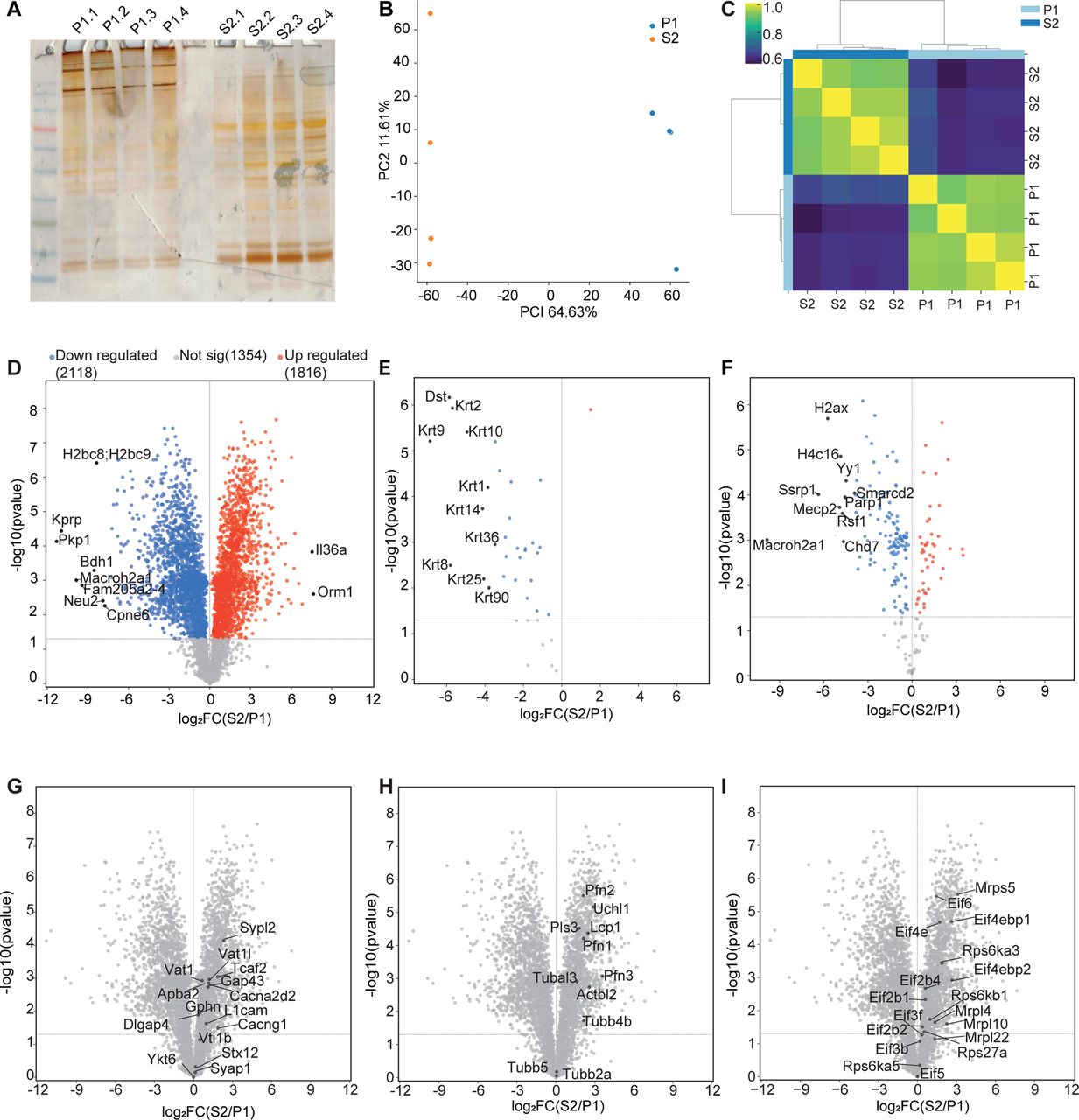 Isolated peripheral terminals from mouse are deficient in histone and keratin.(A) Silver staining of protein isolated from P1 fraction (lanes 1-4) and S2 fraction (lanes 5-8). (B and C) Principal component analysis and heat map with the Pearson correlation coefficient between samples showing high reproducibility of S2 and P1 fractions from n=4 biological replicates. (D) Volcano plot showing relative protein enrichment of S2 compared to P1 fractions. The red and blue dots depict significantly (p<0.05) enriched proteins in S2 and P1, respectively. (E and F) Volcano plots of pre-defined keratin (GO term ‘keratin filaments’) (E) and chromatin-associated proteins (GO term ‘chromatin’) (F). (G-I) Volcano plot of the S2 fraction vs the P1 fraction with manual annotation for pre- and post-synaptic markers and ion channel components (G), cytoskeletal proteins (H) and ribosomal proteins and translation factors.