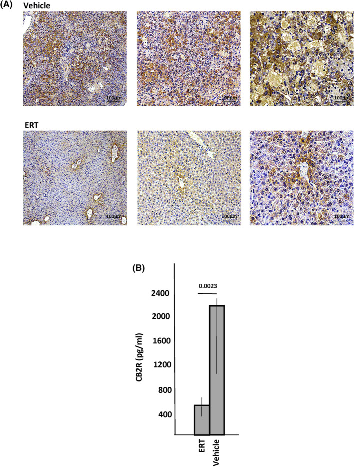 CB2R levels in Farber disease mice following enzyme replacement therapy (ERT). Ten 2.5‐week‐old Farber disease mice were treated once weekly with recombinant acid ceramidase by intraperitoneal injection at a dose of 10 mg/kg. After 6 injections the 8.5‐week‐old mice were euthanized and their livers collected and processed for immunohistochemical (IHC) detection of CB2R (A) or detection of CB2R in plasma by ELISA (B). Representative images are shown (a minimum of 5 sections/mouse were analyzed). Brown staining indicates CB2R. P values are shown in (B), and bar heights indicate the mean values from three independent experiments.