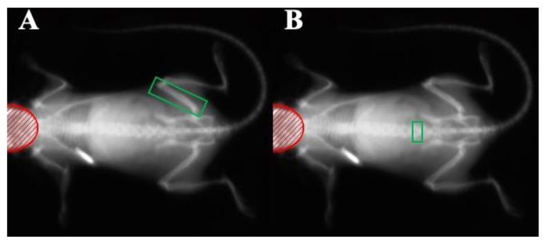 Representative DXA scanning images of a C57BL/6 mouse. (A) A scan with the ROI placed around the distal condyles, diaphysis, and a portion of the femoral neck (femoral head and pelvis excluded from ROI), and (B) the same scan with the ROI placed around the L5 vertebra. The region of interest (ROI) is shown in green. The bright white object at the left scapular region is the implanted subcutaneous microchip used for animal identification.