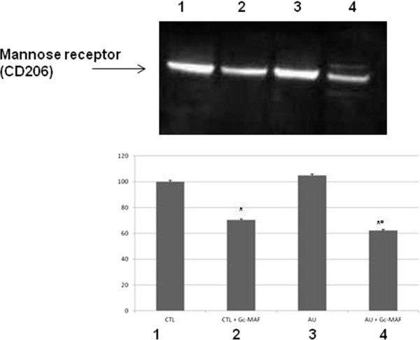 Representative Western blot analysis of mannose receptor protein levels in the blood monocyte-derived macrophages (BMDMs) obtained from the autistic children and the healthy controls. (1) untreated BMDMs from healthy control subjects; (2) GcMAF-treated BMDMs from healthy control subjects; (3) untreated BMDMs from autistic disorder subjects; (4) GcMAF-treated BMDMs from autistic disorder subjects. The histograms indicate percentage variations in mannose receptor protein levels in the BMDMs. * indicates significant difference versus healthy controls; ° indicates significant difference versus GcMAF untreated autistic BMDMs.